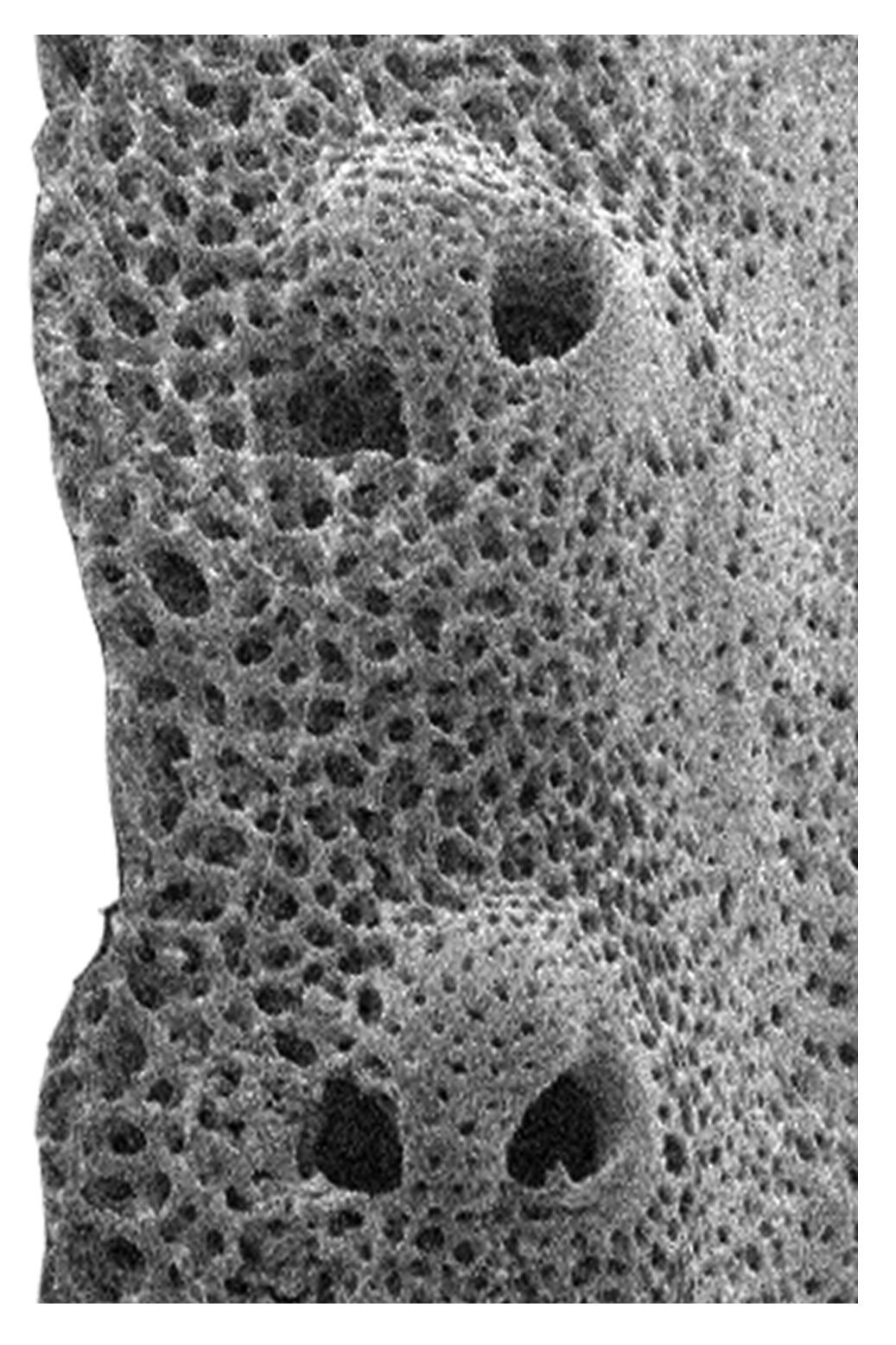 Detalhes de um dos braços da criatura marinha. Essas extremidades apresentam placas que formam o esqueleto interno do animal  (Foto: Ben Thuy/Natural History Museum Luxembourg)