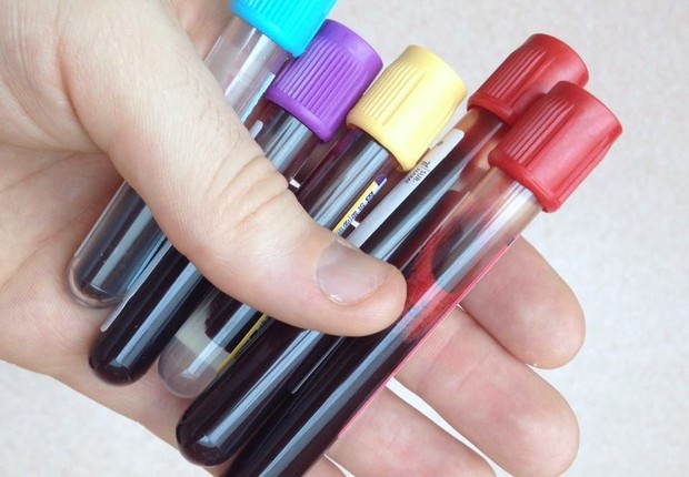 Hemograma, exame de sangue (Foto: Wikimedia Commons)