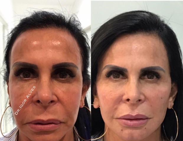 Gretchen (Foto: Instagram/Reprodução)