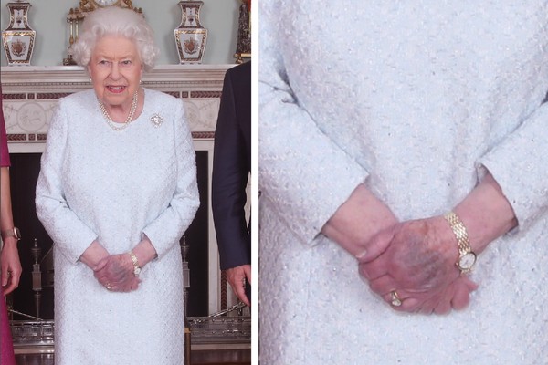 A Rainha Elizabeth 2ª com a marca na mão que assustou seus súditos (Foto: Getty Images)
