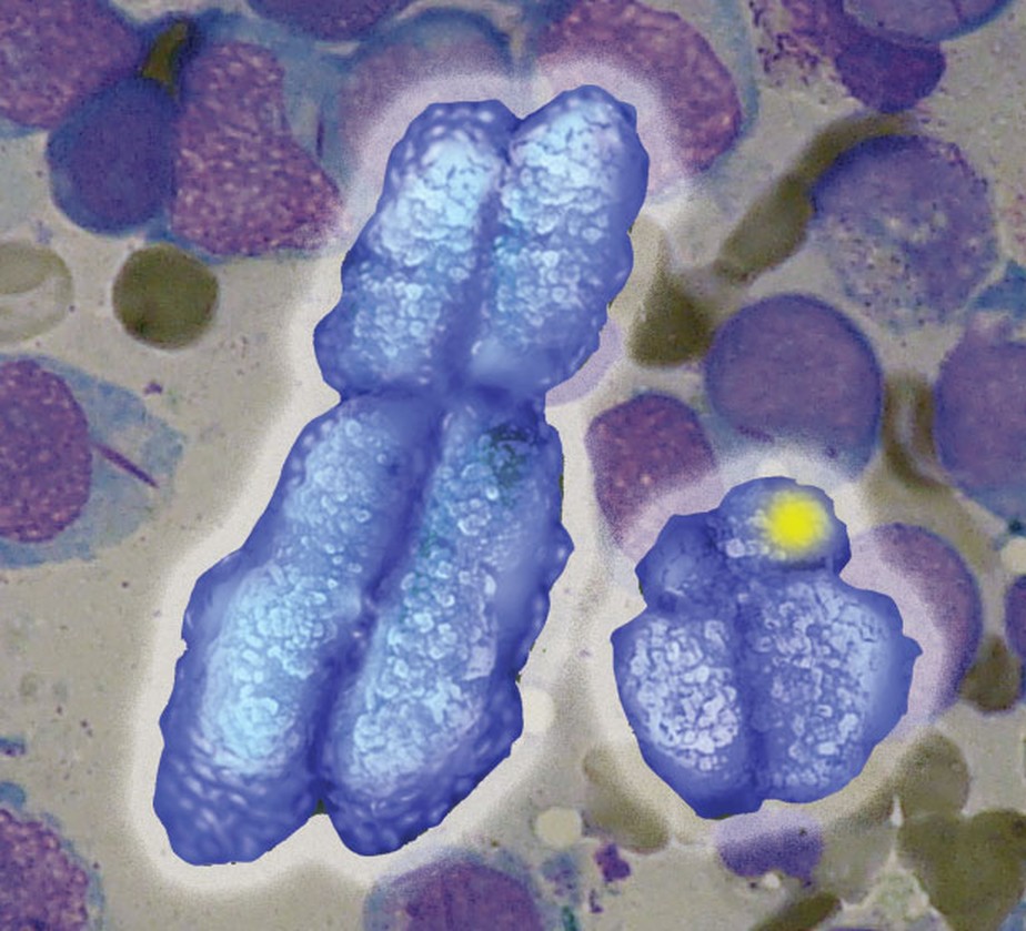 Gene transportado no cromossomo Y é destacado em imagem (em amarelo)