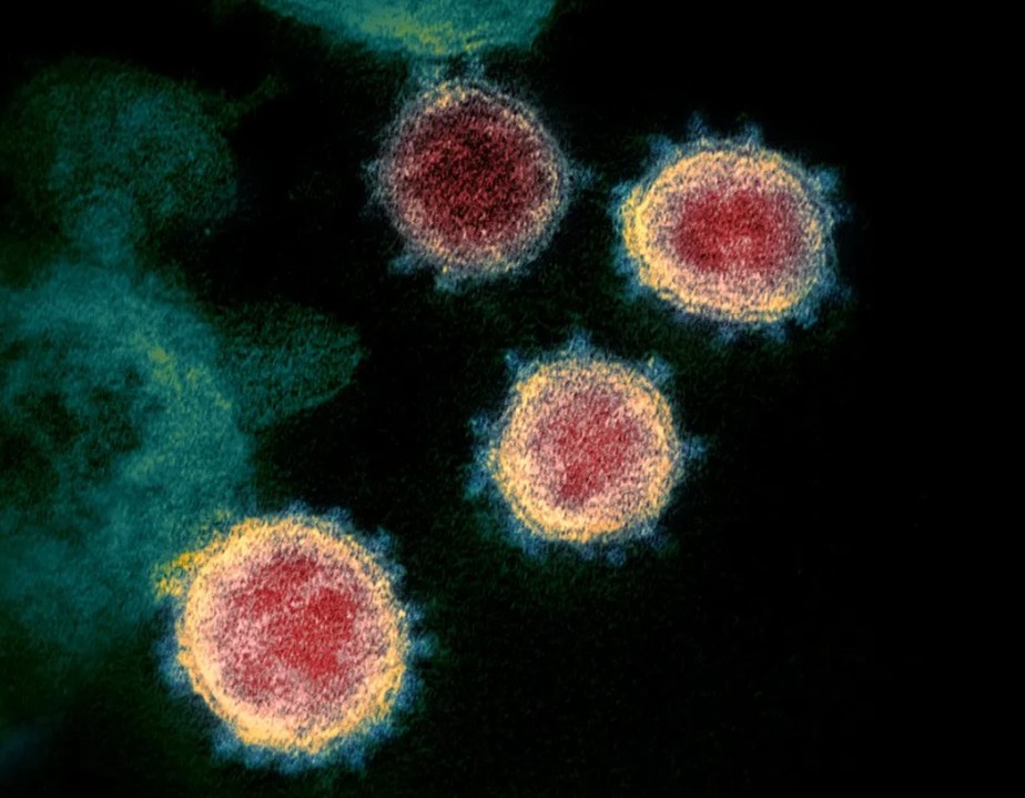 Imagem do coronavírus visto em um microscópio eletrônico.