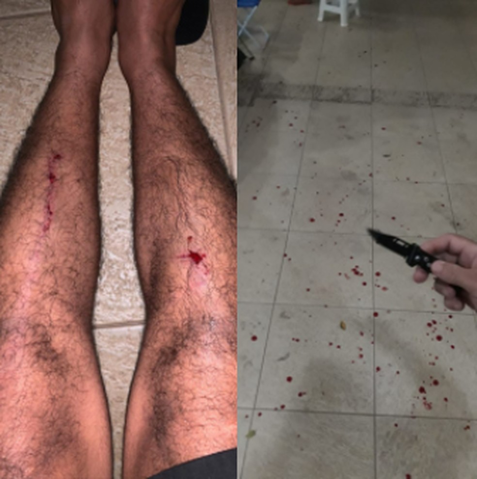 Um dos homens que está acampado caiu e feriu as pernas ao tentar desarmar o morador de rua que estava com canivete e já tinha se ferido. — Foto: Arquivo pessoal