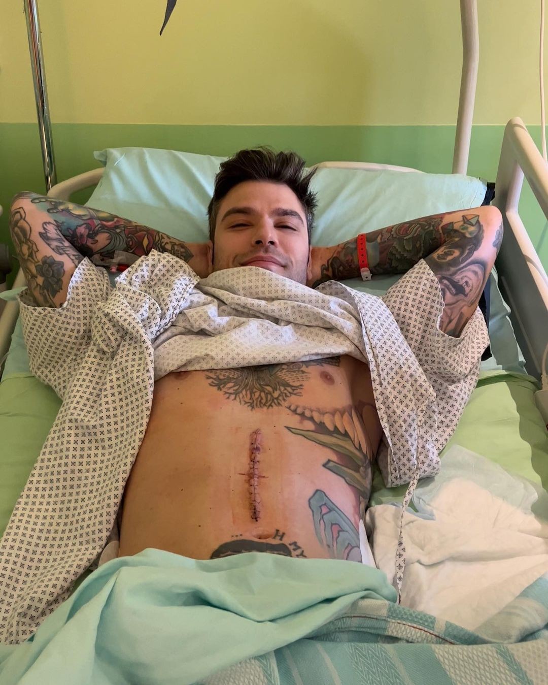 Fedez se pronuncia após passar por cirurgia delicada  (Foto: Reprodução/Instagram )