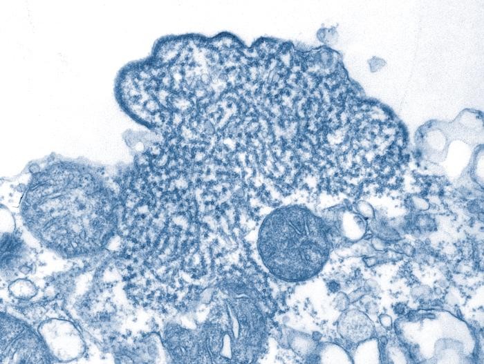 Partículas de vírus Nipah isolados da amostra de líquido cefalorraquidiano (LCR) de um paciente (Foto: Wikimedia Commons )