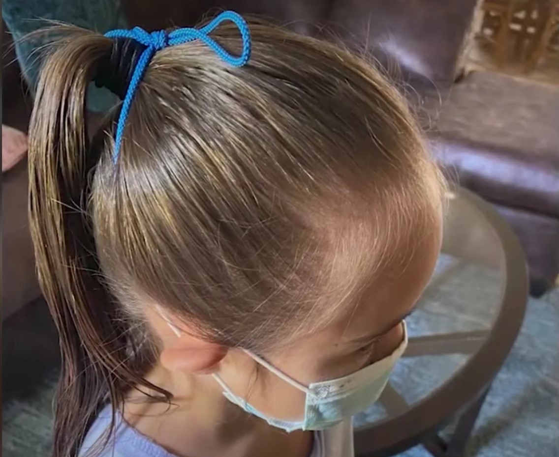 Pai acusa escola de amarrar máscara na cabeça de filha com sindrome de down (Foto: Reprodução / Fox News)