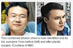 Montagem mostra homem identificado com o sobrenome Yoon, antes e depois da cirurgia (Foto: Reprodução)