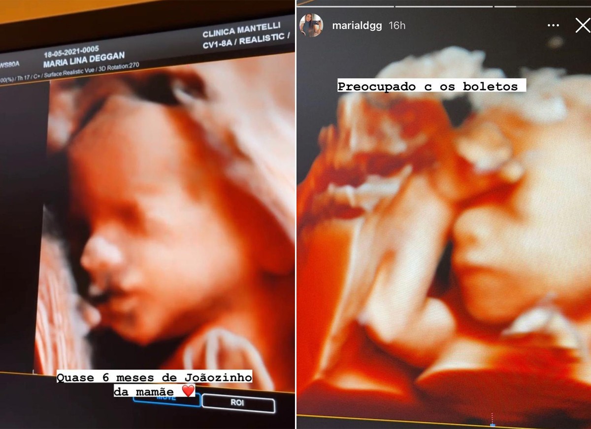 Maria Lina Deggan e Whindersson Nunes esperam o primeiro filho (Foto: Reprodução / Instagram)