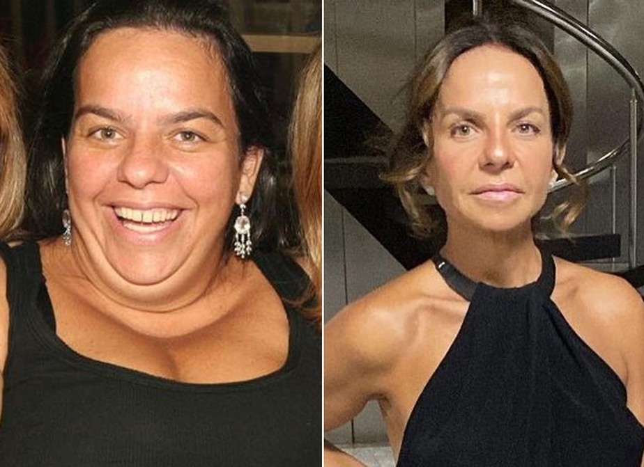 Cynthia Sangalo antes e depois da bariátrica