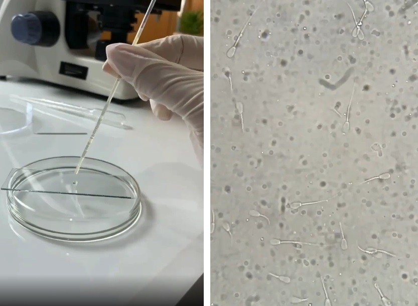 A cientista ampliou a imagem de uma gota de sêmen para mostrar quantidade de espermatozoides (Foto: Reprodução/ Instagram)
