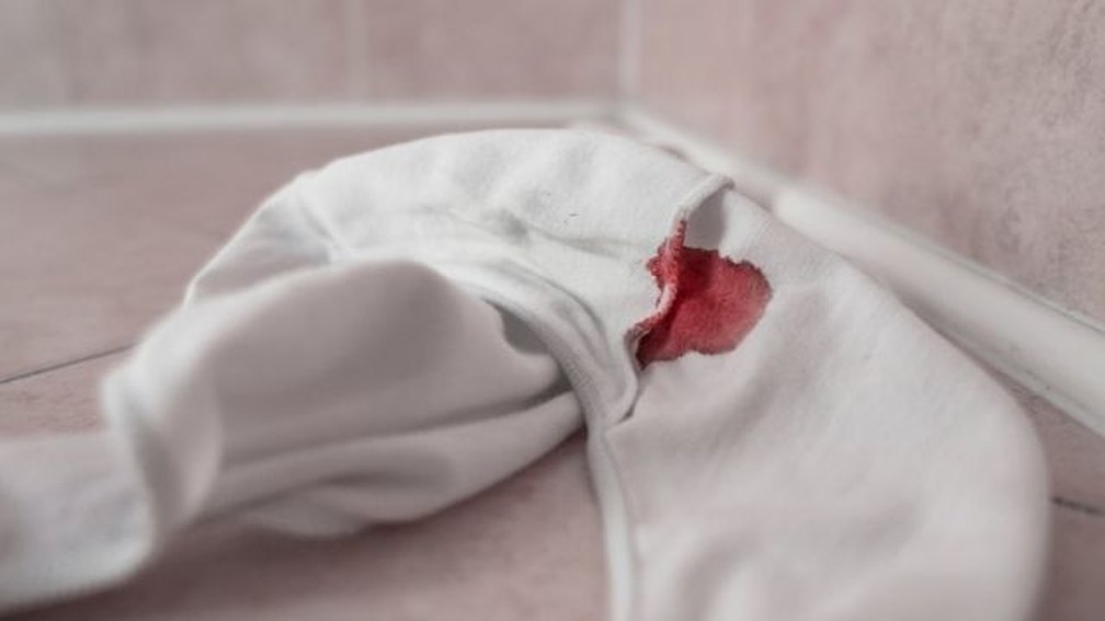 Dismenorreia secundária pode durar todo o tempo do sangramento e costuma se manifestar em idade adulta — Foto: Getty Images/via BBC
