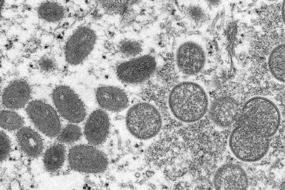 Vírus da varíola do macaco — Foto: Cynthia S. Goldsmith, Russell Regner/CDC via AP