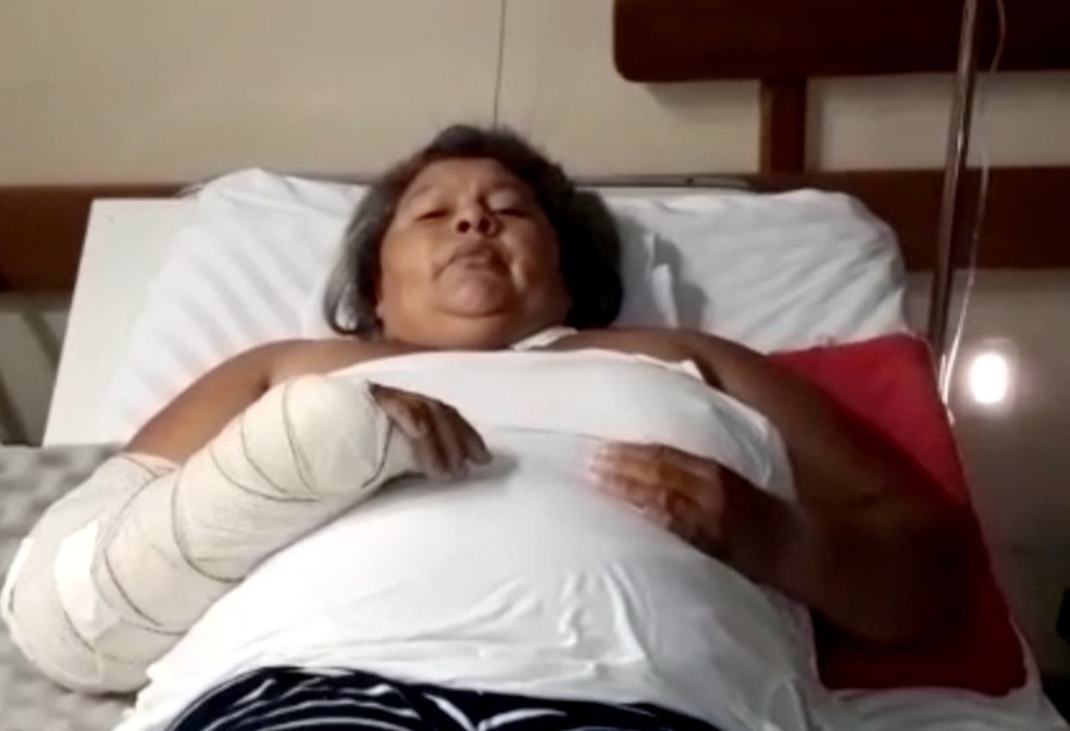 Mulher que teve os dois braços quebrados só operou um membro — Foto: Reprodução/TV Anhanguera