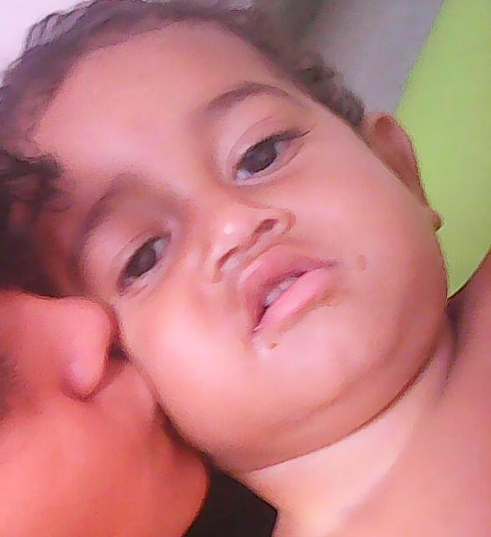 Bebe De 1 Ano Atingido Com Tiro Na Cabeca Segue Em Estado Grave Na Uti Diz Tia Acre G1