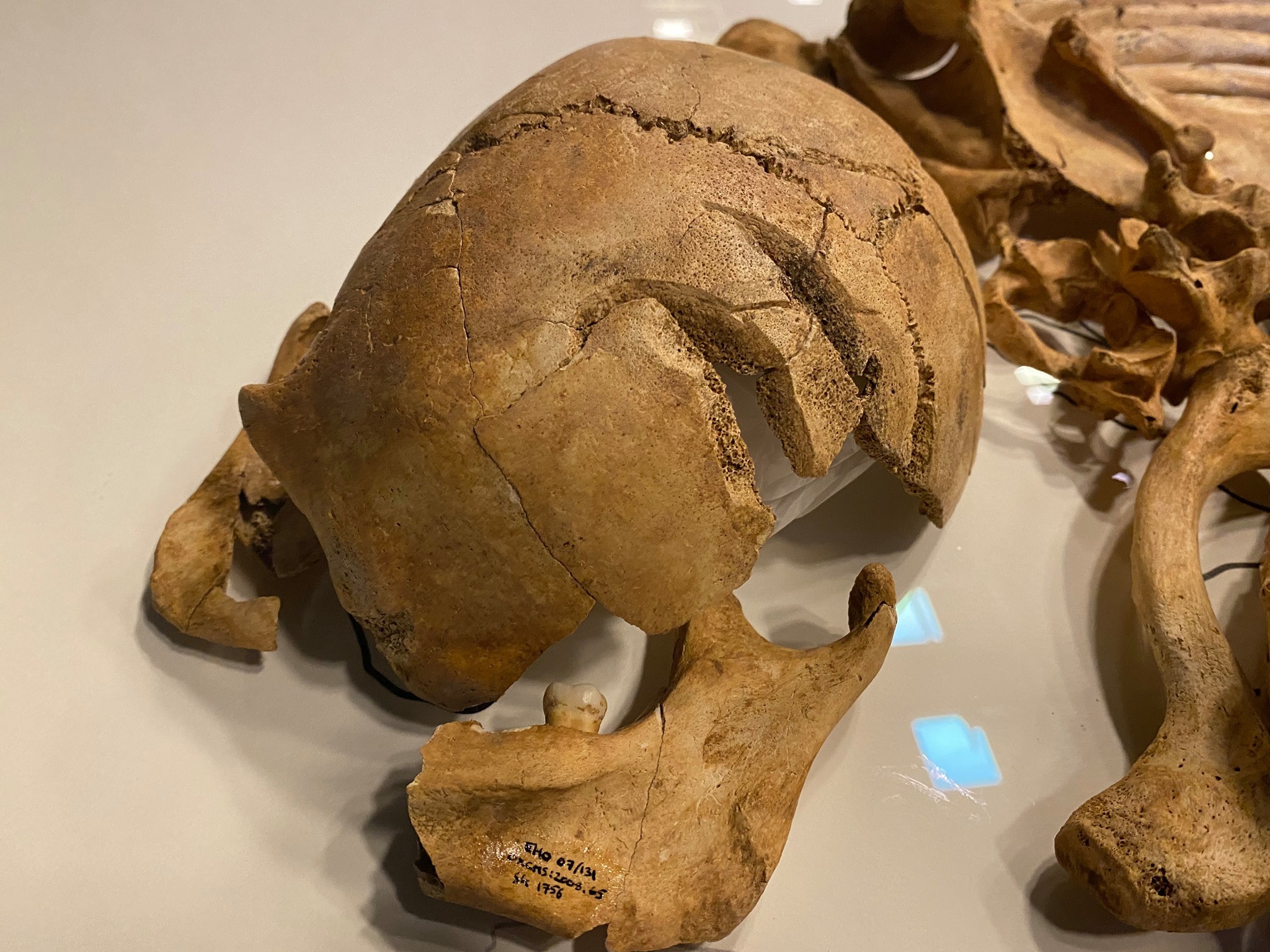Crânio de guerreiro viking no Museu Nacional da Dinamarca (Foto: Nationalmuseet/Facebook/Reprodução)