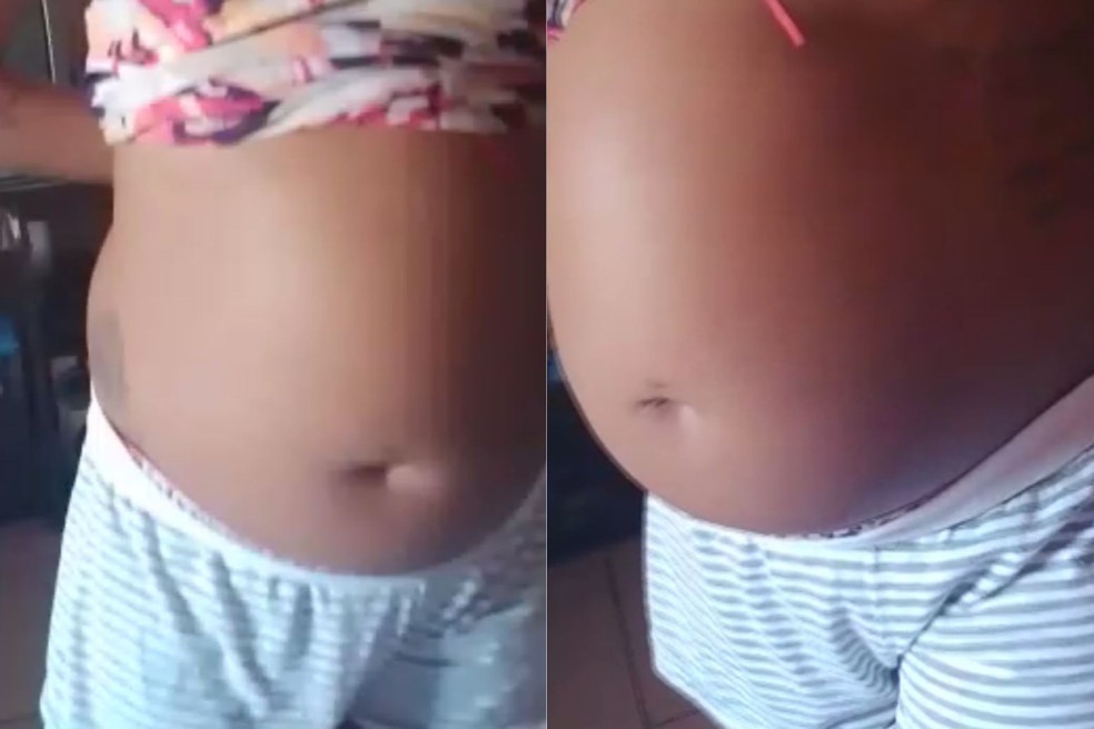 Cristiane Gomes Corrêa, de 34 anos, está sofrendo há três meses com inchaço da barriga e dores em Juquiá (SP) — Foto: Arquivo Pessoal