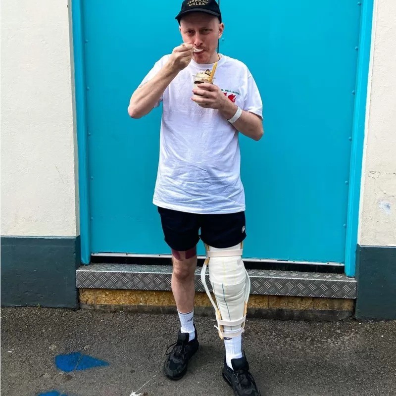 Scott Neil hoje consegue viver uma vida normal, mas esteve perto de perder a perna — e a vida (Foto: SCOTT NEIL via BBC)