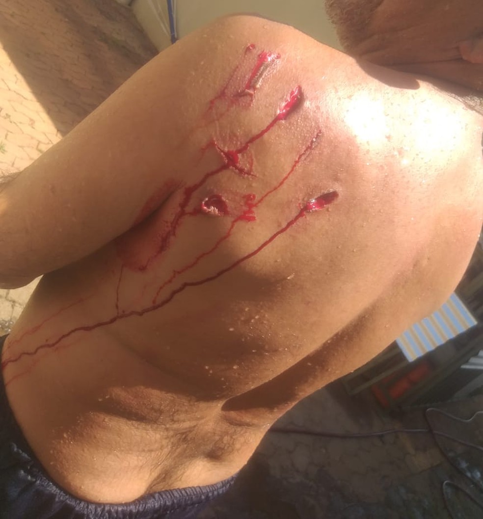 Marcas do ataque de capivara, sofrido por marinheiro do Clube da Aeronáutica no DF — Foto: TV Globo/Repdução