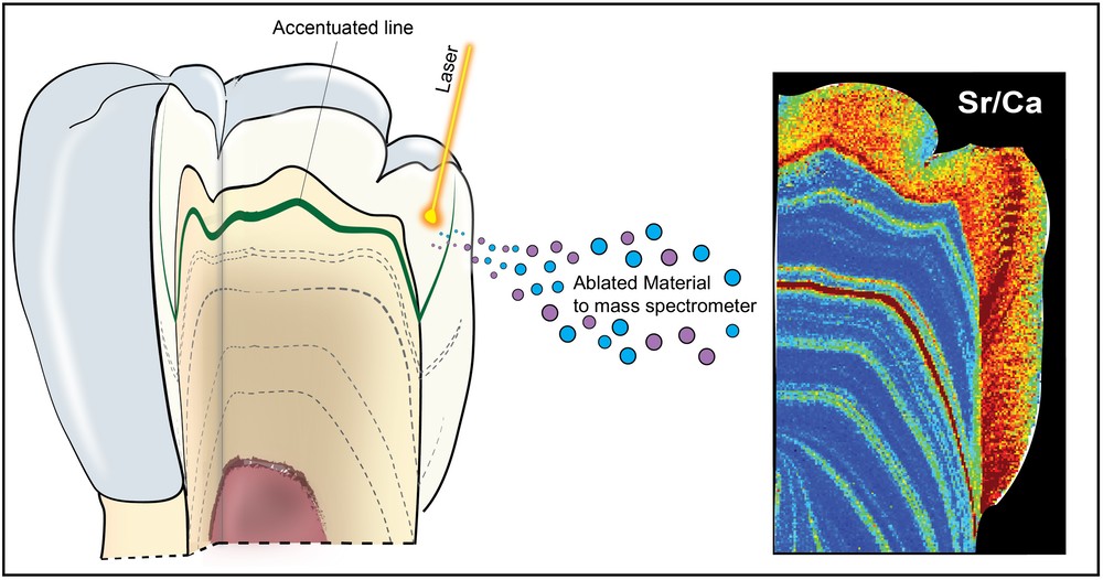 Diagrama esquemático do uso da análise de ablação a laser para mapear a concentração de estrôncio e urânio dentro de um dente (Foto: Renaud Joannes-Boyau/Southern Cross University)