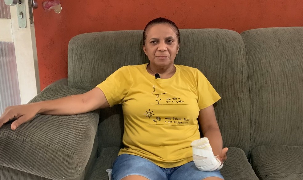Dona de casa tem dois dedos mutilados em acidente com cadeira no HGV — Foto: Laura Moura/ g1