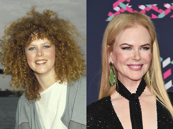 Nicole Kidman (em 1983 e em 2016) (Foto: Getty Images)