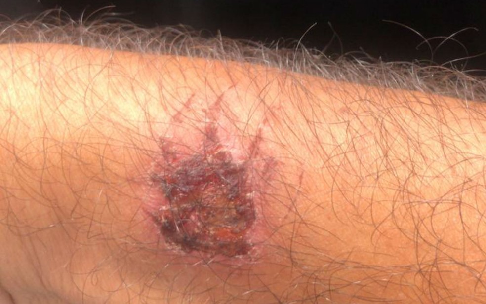 Motorista de aplicativo relata assédio e agressão após corrida durante carnaval — Foto: Arquivo pessoal