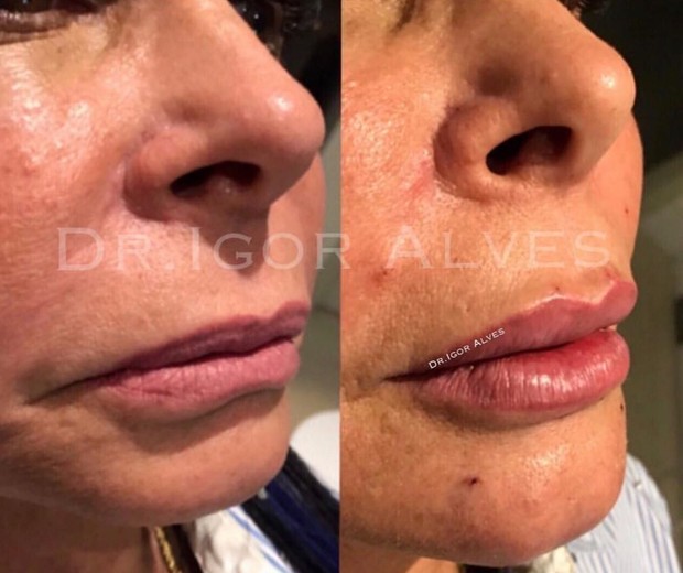 Gretchen (Foto: Instagram/Reprodução)