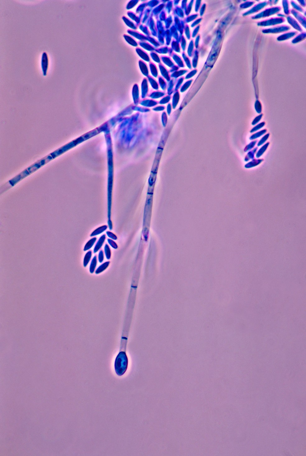 Fusarium verticillioides é um dos causadores da podridão vermelha — Foto: Divulgação/Esalq-USP