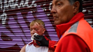 Participante ferido recebe atendimento médico — Foto: Miguel Riopa / AFP