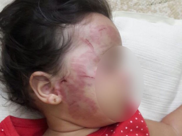 Bebê de 11 meses sofre agressão em creche particular, segundo os pais da menina (Foto: Arquivo pessoal)