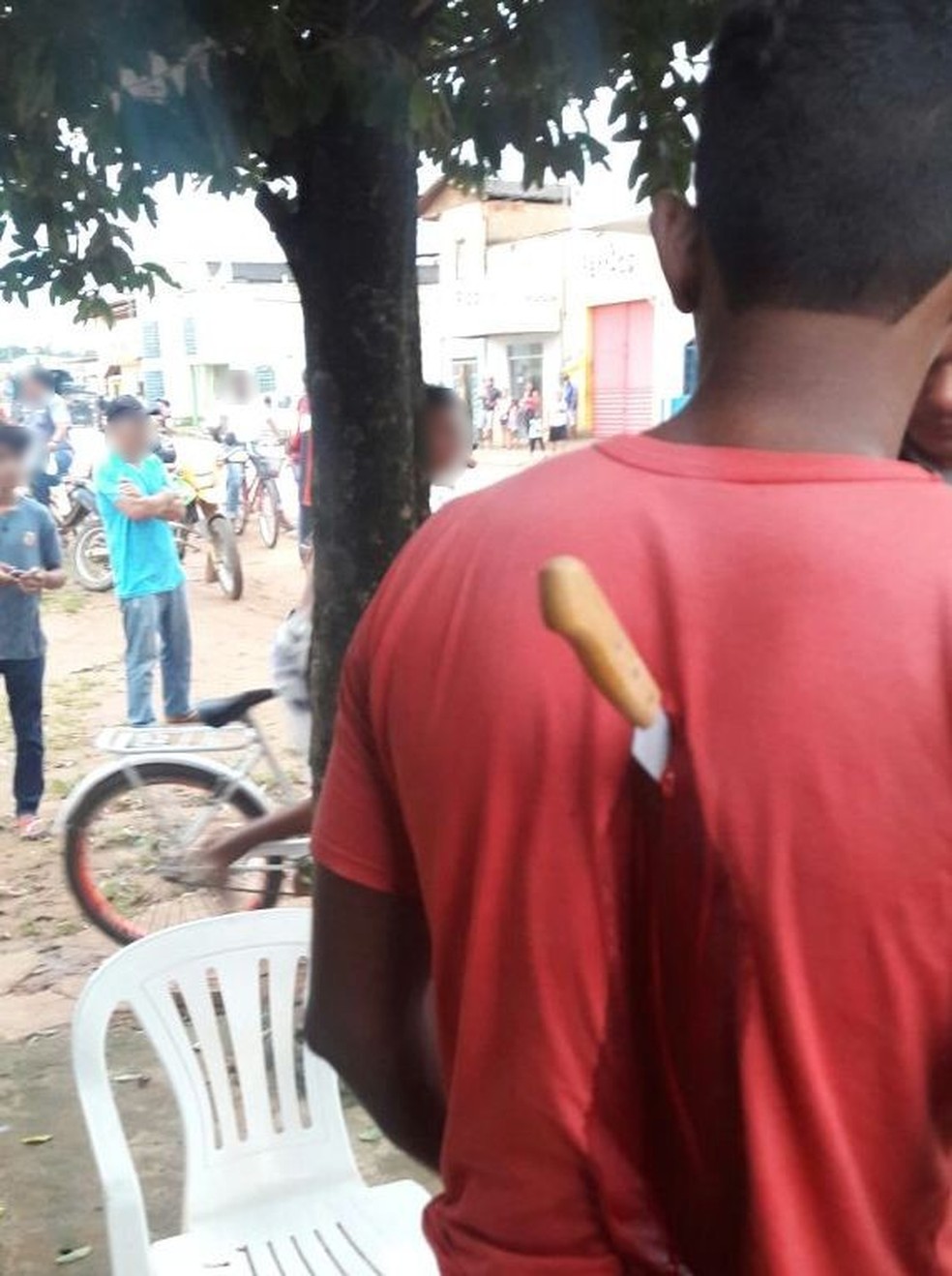 Jovem ficou com faca cravada nas costas após briga em Brasileia (Foto: Reprodução/Reprodução/WhatsApp)