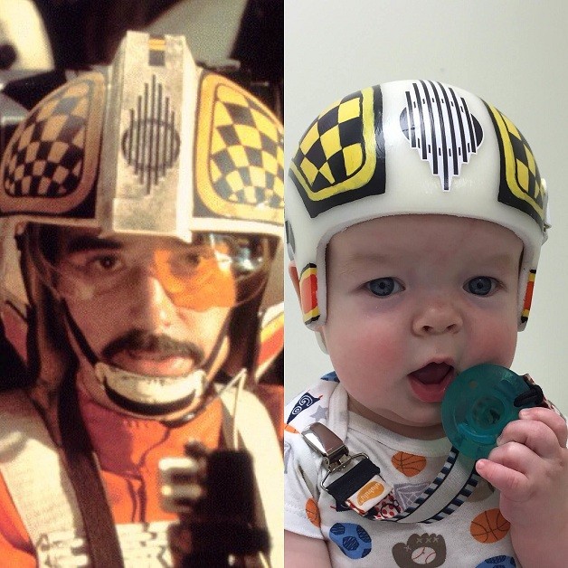 Jack precisou usar por um ano um capacete para corrigir a craniossinostose (Foto: Reprodução/Instagram)