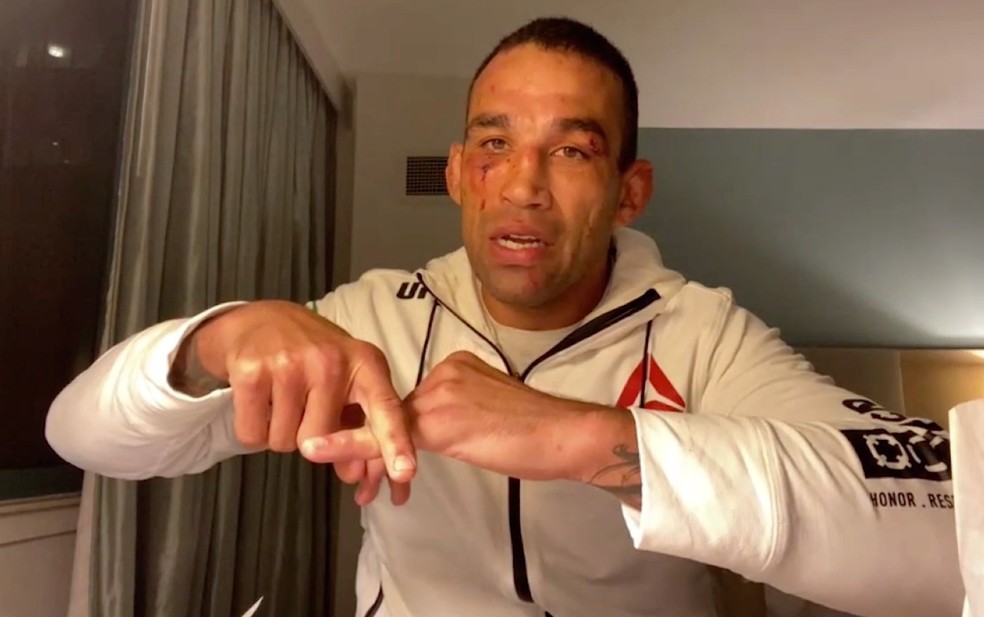 Fabricio Werdum mostra o dedo que saiu do lugar na luta contra Oleynik no UFC 249 — Foto: Reprodução