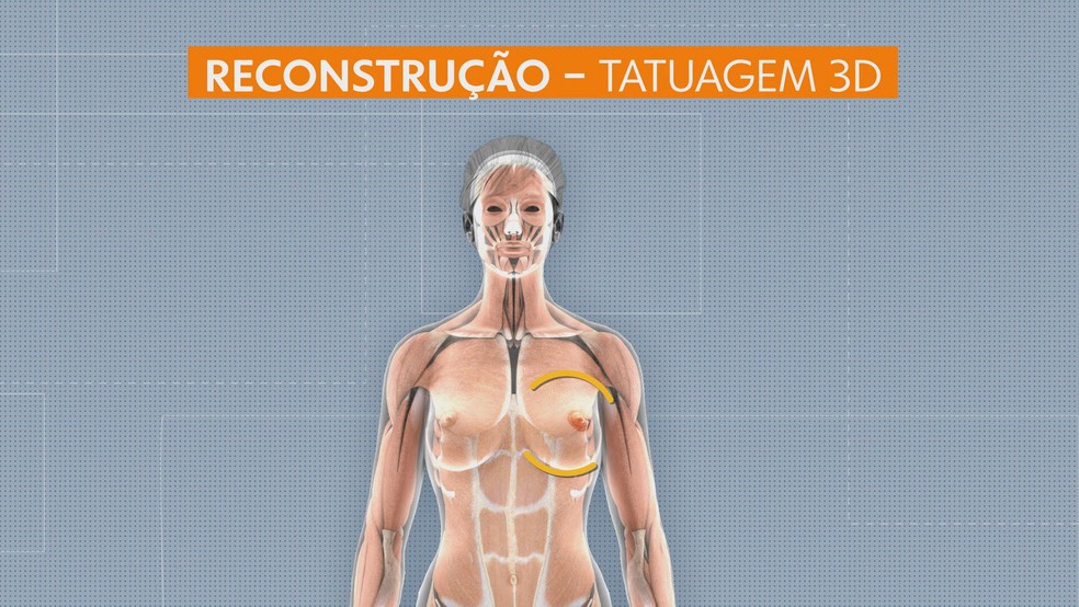 Tatuagem 3D é estimula a autoestima das mulheres — Foto: Reprodução/TV Globo