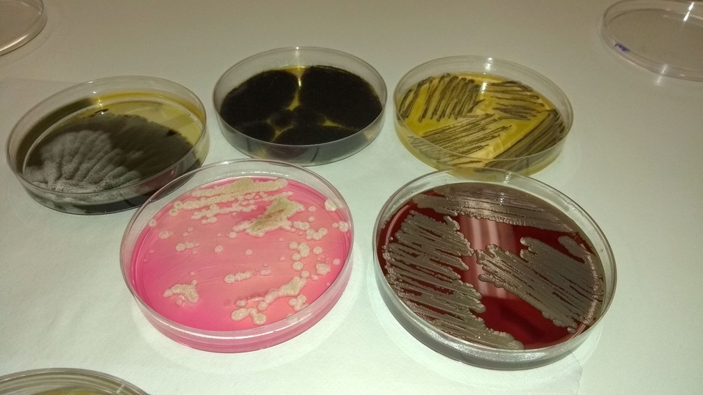Bactérias e fungos encontrados nos fones de ouvido na pesquisa realizada em Campinas (Foto: Patrícia Teixeira / G1)