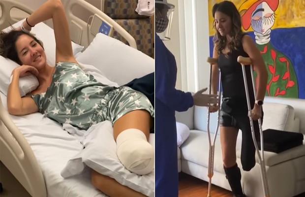 Miss Colômbia celebra a vida 2 anos após amputar perna: 'Difícil, mas decidi sorrir'  (Foto: Reprodução/ Instagram)