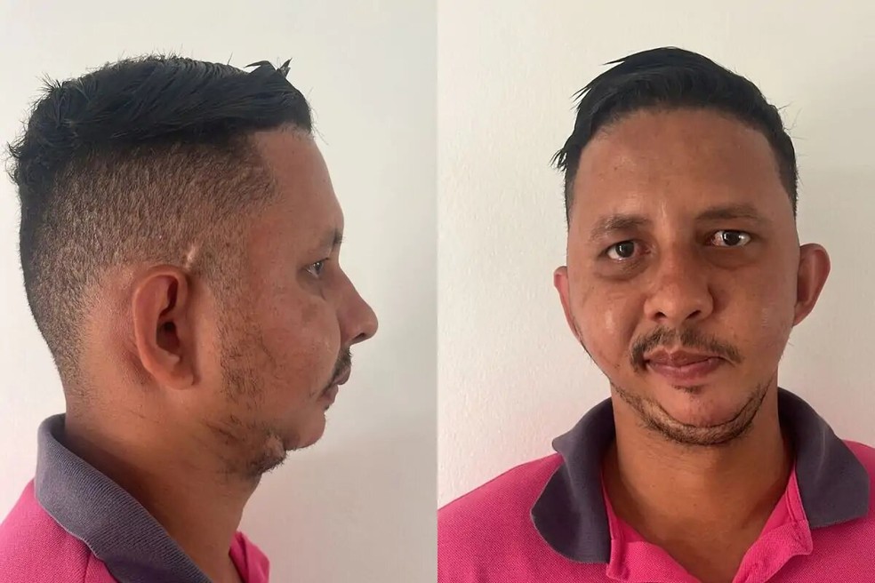 Luiz Antônio passa por seis cirurgias e ainda precisa passar por mais uma  — Foto: Cedida