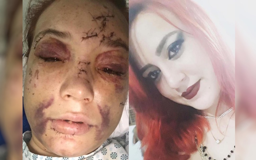 Ana Júlia Costa Pereira Pouso Alto depois e antes de ser agredida — Foto: Divulgação/ Polícia Civil