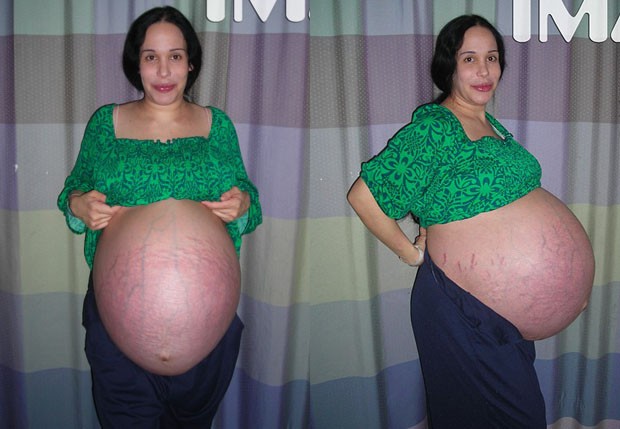 Nadya Suleman na reta final da gravidez, em 2009 (Foto: TMZ)