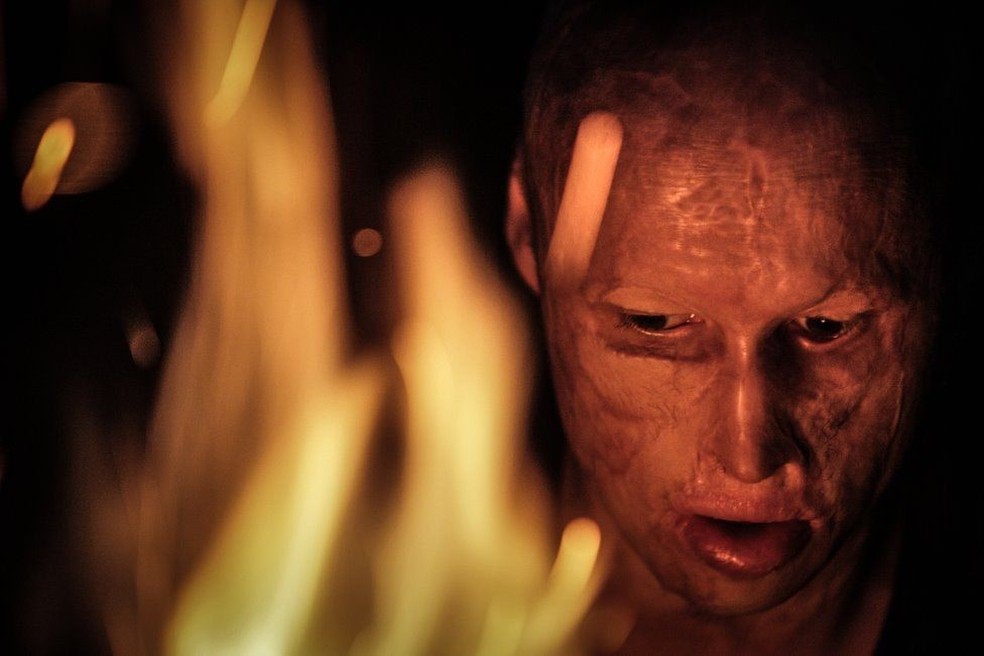 Apesar do que aconteceu, Lyosha diz que gosta de fogo e pode ficar olhando as chamas por horas — Foto: Pavel Volkov/ BBC