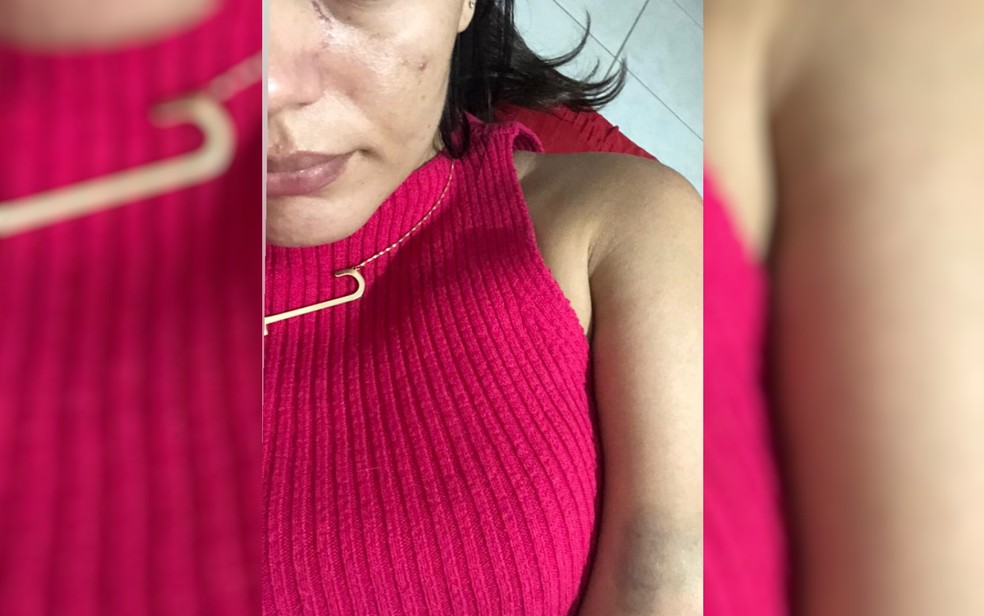 Jéssika da Silva Camargo posta foto com ferimento no rosto e afirma ter sido agredida pelo ex-namorado em Jaraguá, Goiás — Foto: Jéssica Camargo/Arquivo pessoal