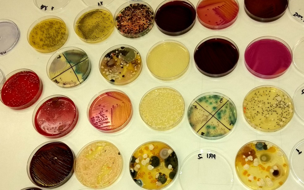 Número de bactérias e fungos encontrados nos produtos infantis ultrapassa 720 milhões de micro-organismos (Foto: Patrícia Teixeira/G1)