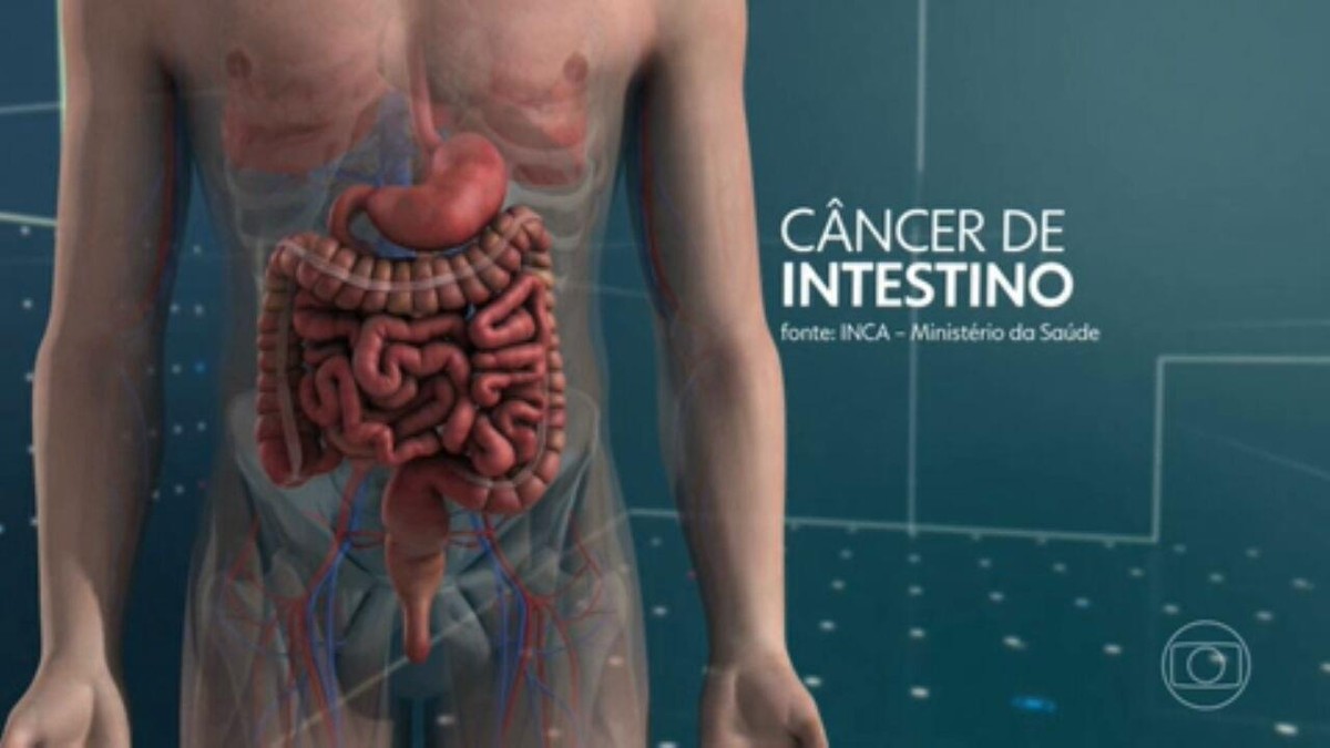 Número de casos de câncer de intestino cresce no Brasil