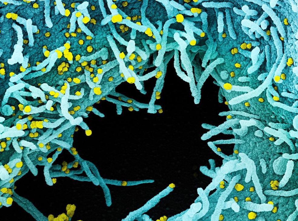 Micrografia eletrônica de uma célula infectada por partículas do SARS-CoV-2 (amarelo) — Foto: Integrated Research Facility (IRF)/NIAID