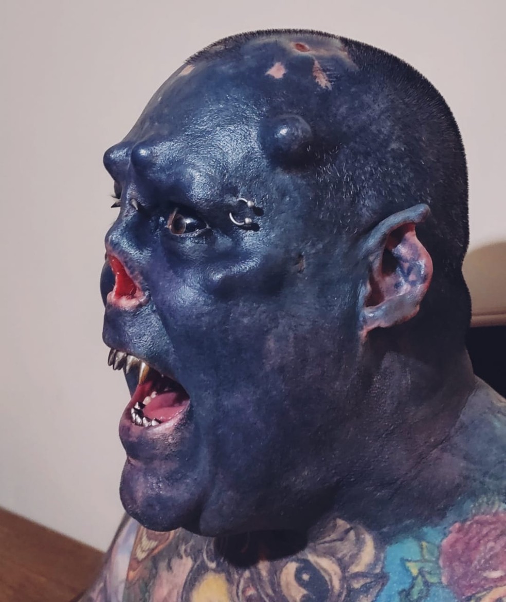 Morador de Tatuí mutilou orelhas e nariz — Foto: Fernando Franco/Arquivo pessoal