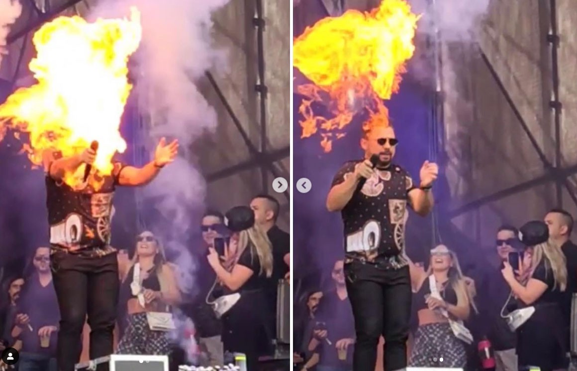 Xand Avião se queima durante show em São Paulo e brinca: 'Dublê do Nicolas Cage'