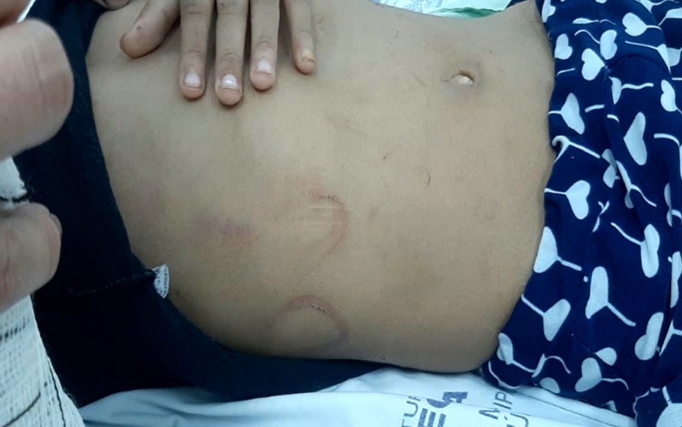 Menina de 4 anos está internada em hospital de Goiânia — Foto: Reprodução/TV Anhanguera