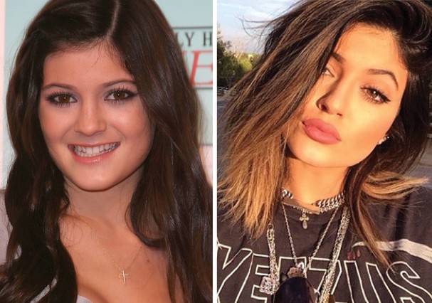 Kylie Jenner em foto de 2010 e em selfie atual (Foto: Getty Images / reprodução Instagram)