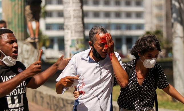 Homem que não participava do protesto é ferido no olho por tiro de bala de borracha disparada pela PM 