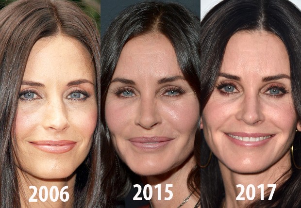 As mudanças no rosto de Courteney Cox com o passar dos anos (Foto: Getty Images)